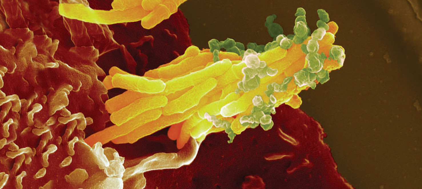 mycoplasma hominis